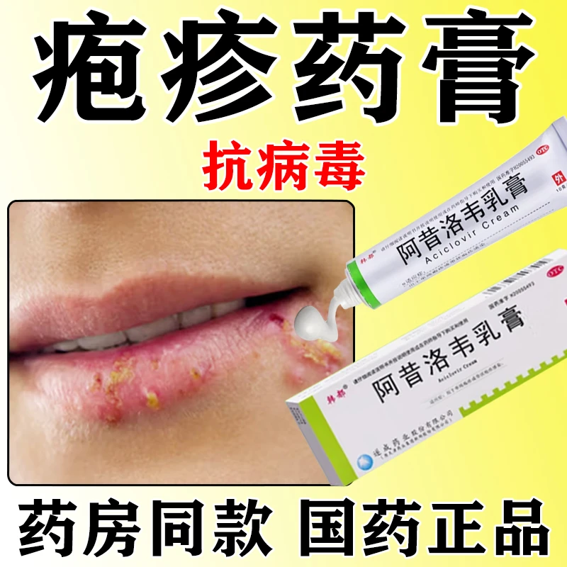疱疹药膏单纯疱疹口唇疱疹感染药膏 韩都阿昔洛韦乳膏3%*10g
