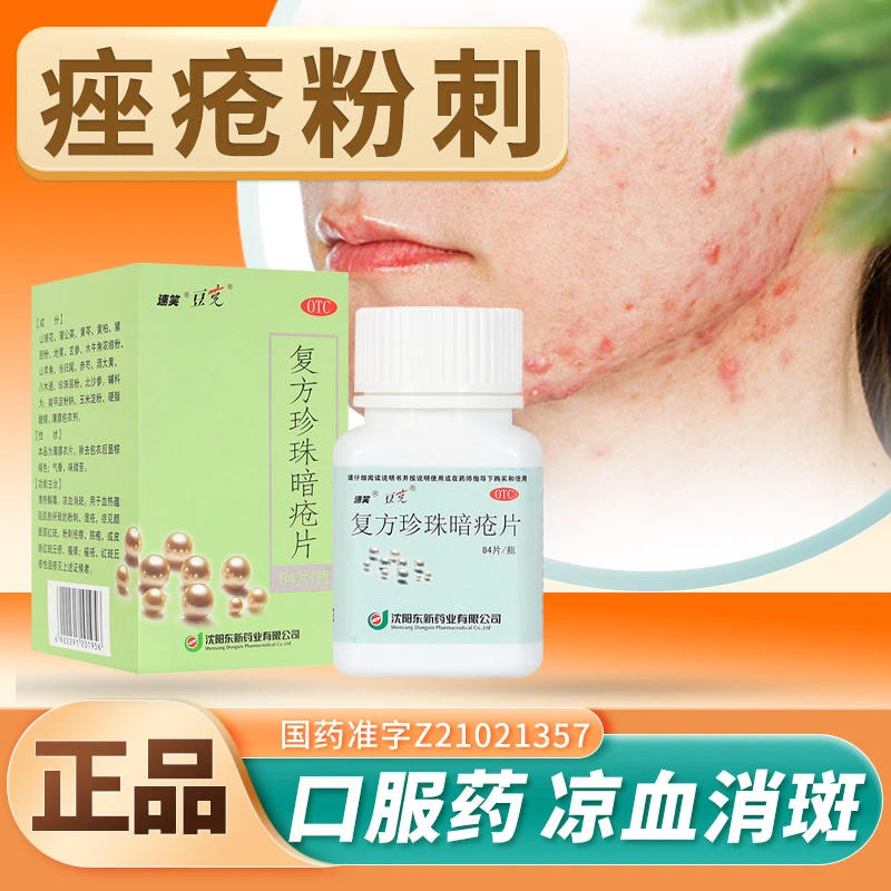 速笑血热所致粉刺疙瘩脓包痤疮红斑丘疹复方珍珠暗疮片0.3g*84片