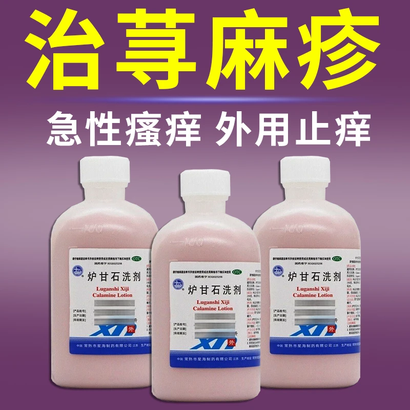 星海炉甘石洗剂100ml 治荨麻疹药 红疹长疙瘩急慢性荨麻疹过敏药