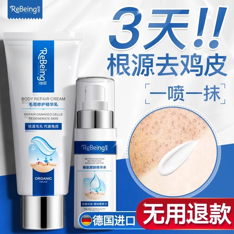【德国进口】鸡皮肤疙瘩毛囊角化大腿手臂毛孔堵塞皮肤干燥粗糙乳膏