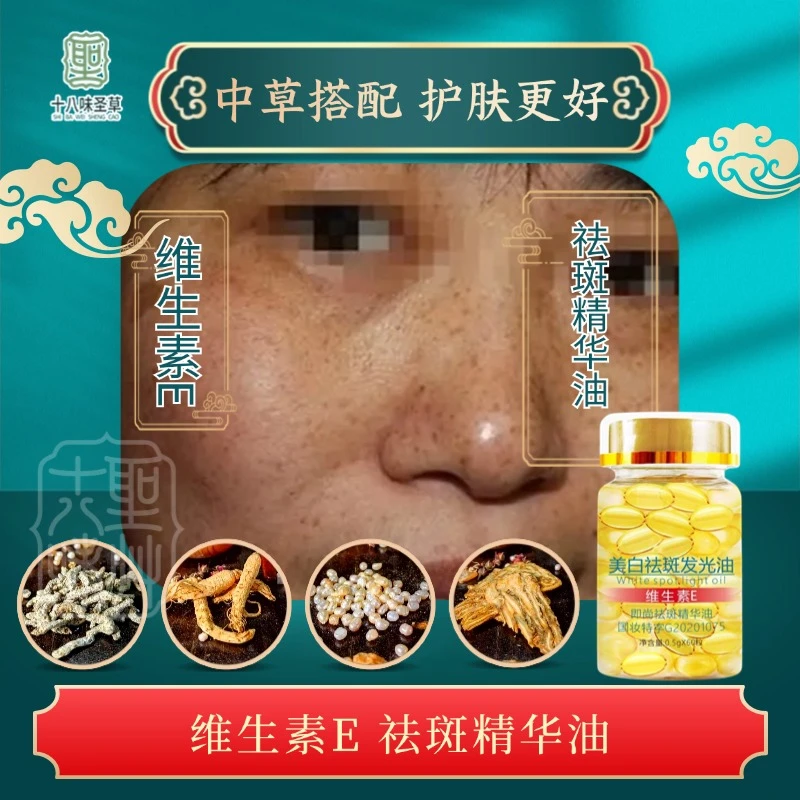 维生素E祛斑美白精华油淡斑补水保湿面部涂抹精华油发光油软胶囊