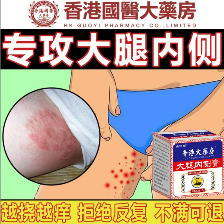 大腿内侧止痒膏男下大腿体痒腹股沟痒特效止痒草本抑菌正品