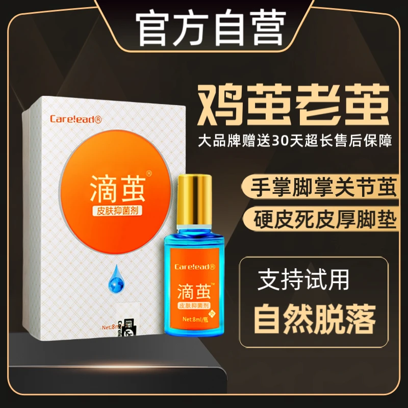 【滴茧正品】老茧去除软化剂刺除手脚鸡茧脚垫猴死皮硬皮草本修护膏