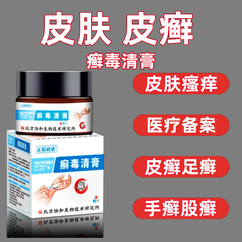 逸路康北京协和导光凝胶癣毒清膏牛皮癣体癣股癣凝胶 牛皮癣药膏 冷敷凝胶 皮肤癣顽固癣止痒治癣药膏 顽固癣皮癣止痒药膏