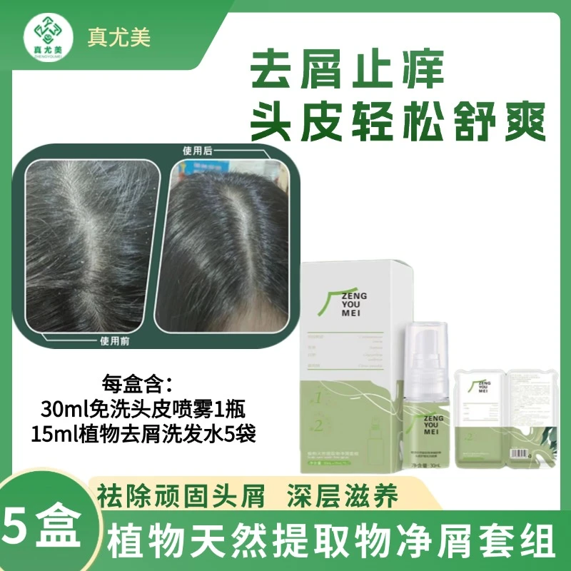 真尤美柔顺天然提取去屑套组持久头皮护理免洗喷雾止痒修护洗发