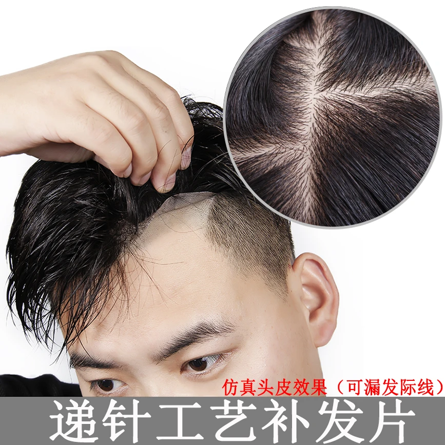 (全递针)男士假发补发片假发块卡子胶片真发假发男补发秃顶假发