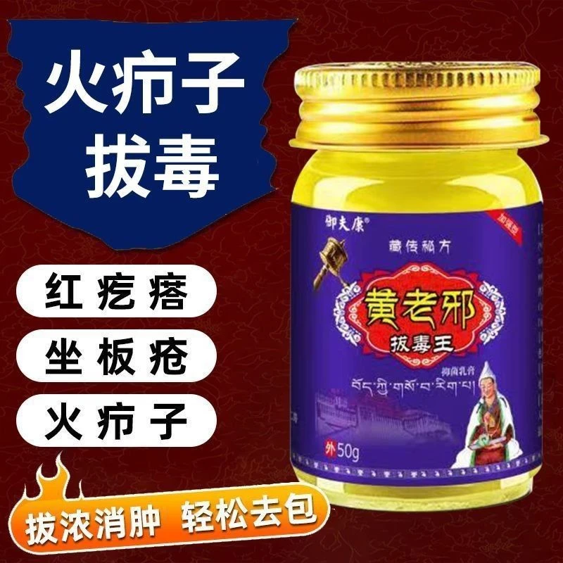 【黄老邪】火疖子神器草本止痒乳膏护理软膏身上痒皮肤抑菌舒缓痒