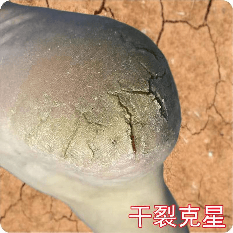 脚底干裂疼痛裂口干燥起皮开裂专用去脚干脚裂皲裂防足裂脚干裂膏