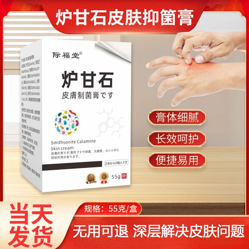 炉甘石皮肤抑箘膏 皮肤瘙痒不适外用乳膏 消红肿艾灸膏湿痒膏