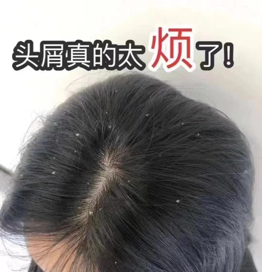 安之酸头皮净化尊享套盒