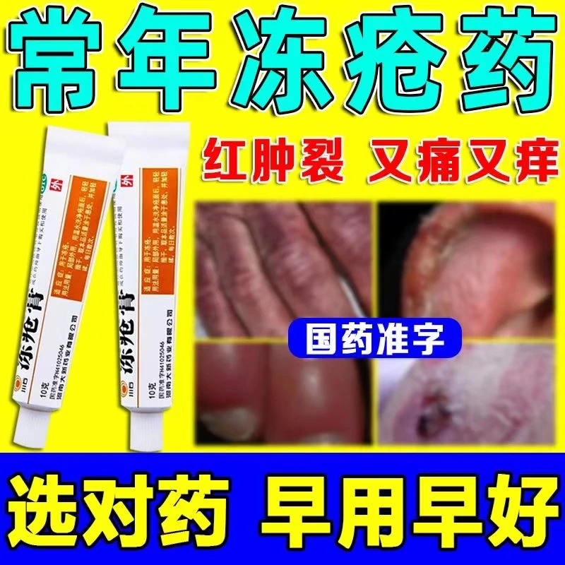 川石冻疮膏10g手脚冻疮耳朵脸部脚跟干裂冻伤冻伤药膏