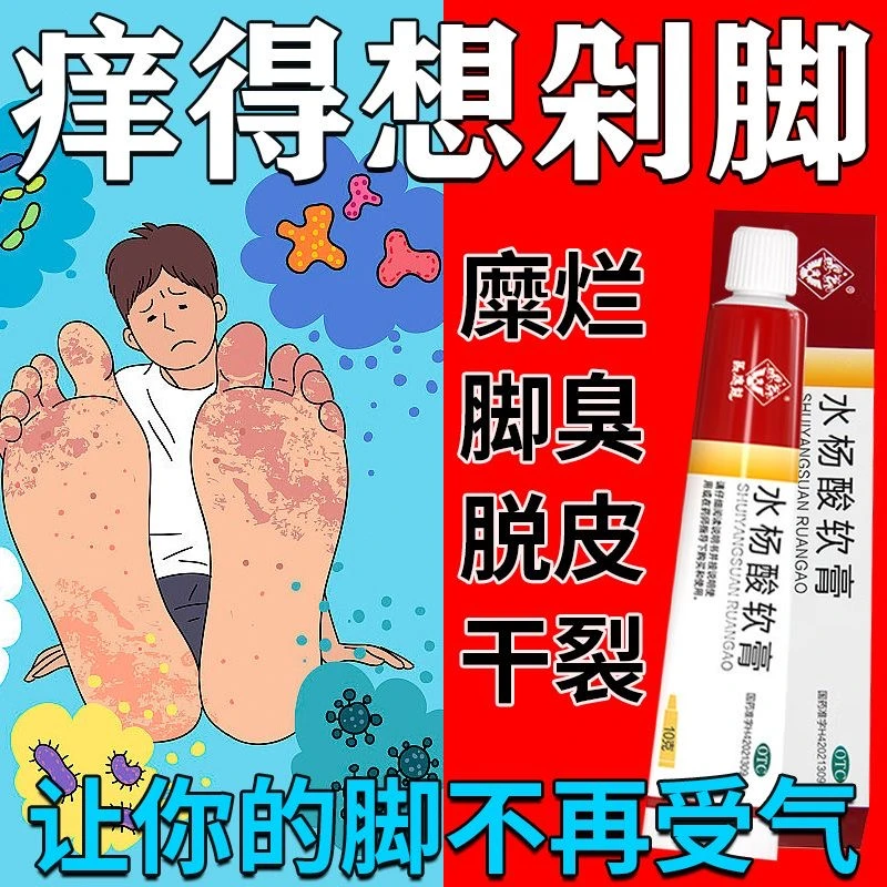 马应龙水杨酸软膏 5%*10g头癣足癣真菌感染角质死皮老茧鸡皮