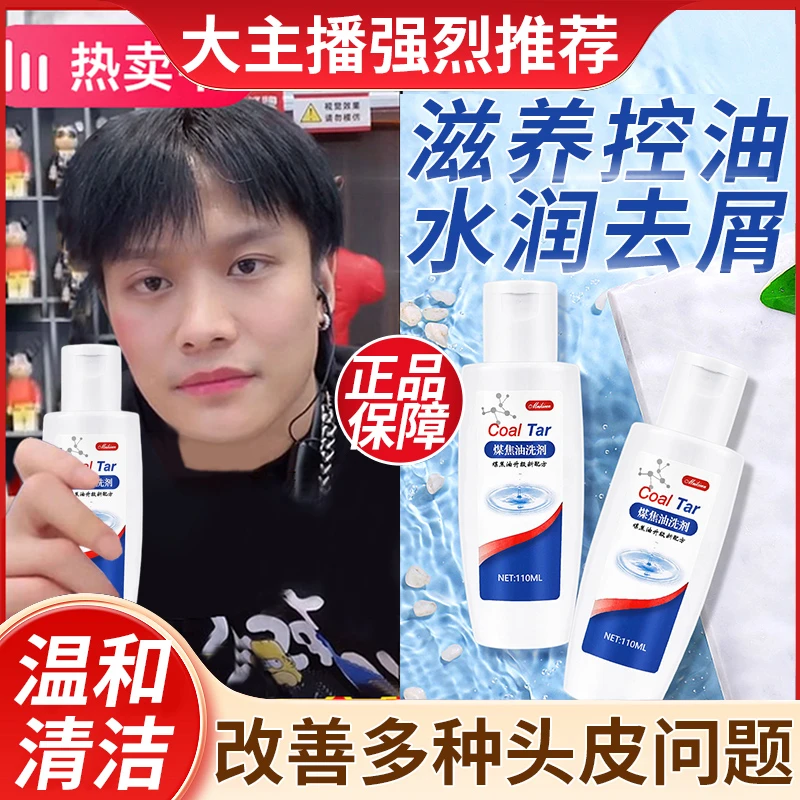 煤焦油洗剂1％脂溢性头皮洗发露清爽留香温和滋养顺滑去屑洗发水