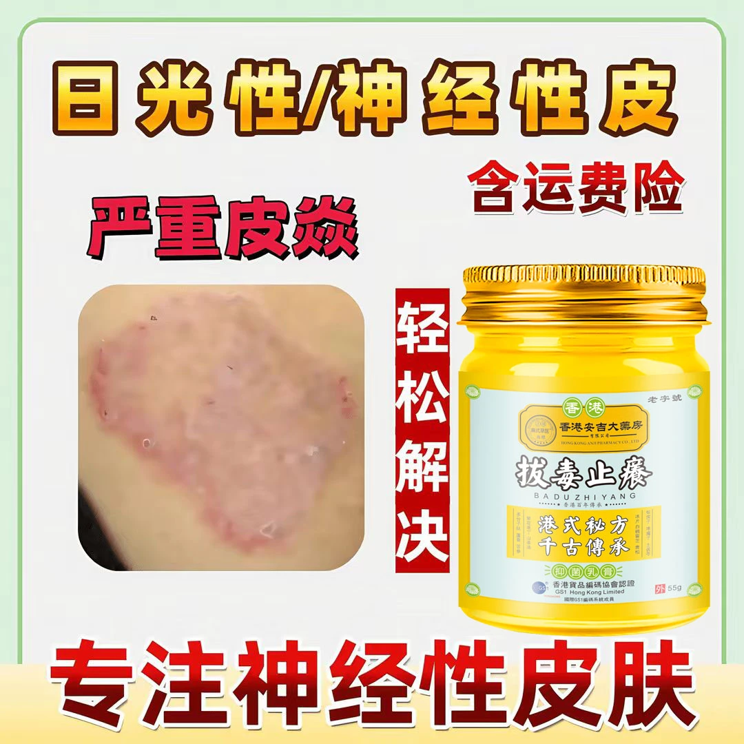 神经性皮肤日光性脂溢性止痒膏顽固皮手足湿痒抑菌乳膏正品