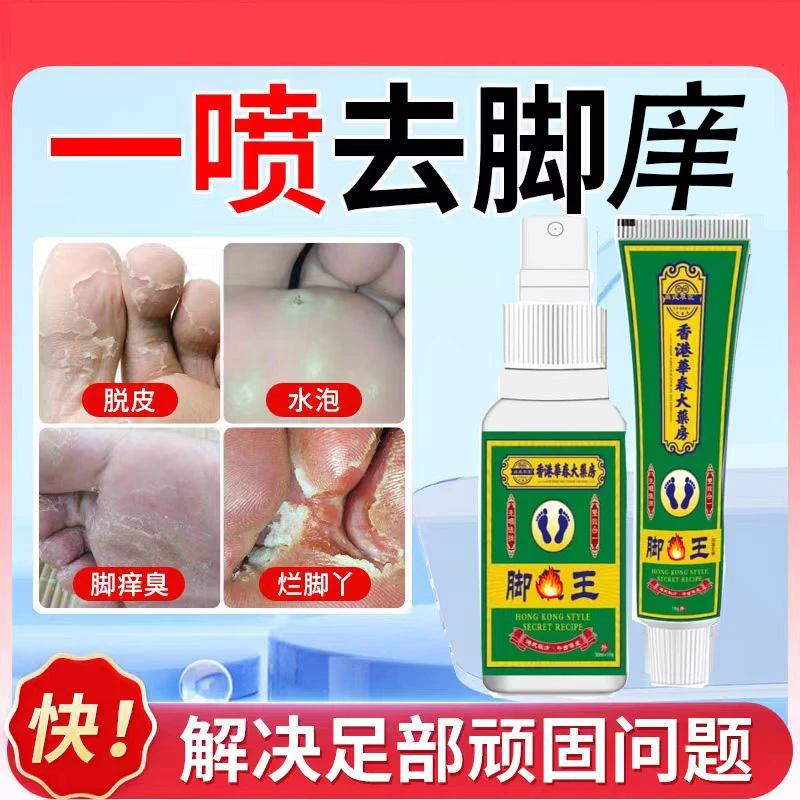脚痒王脚痒脚臭止痒烂脚水泡脱皮草本萃取脚趾缝烂喷剂涂抹外用