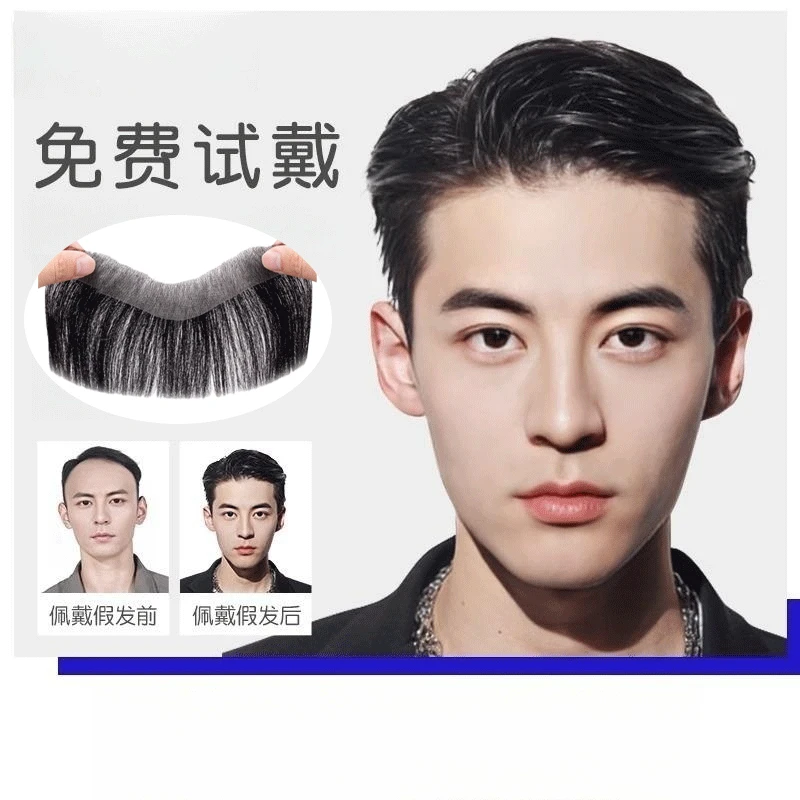 发际线假发贴男士假发片隐形无痕贴片真发M型前额补发片刘海片男