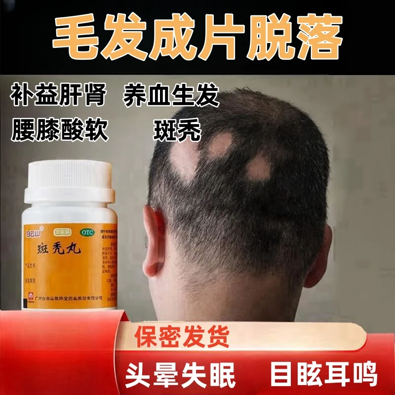 白云山 斑秃丸 35g 补益肝肾养血生发肝肾不足毛发成片脱落斑秃