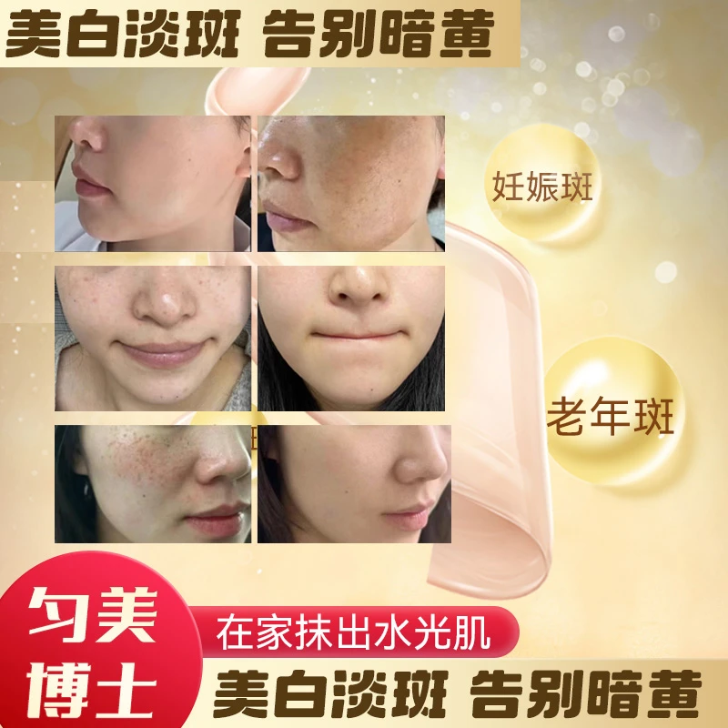 [拍一发二]d2222祛1斑1液美白新品修护美颜在家神器补水清新保湿