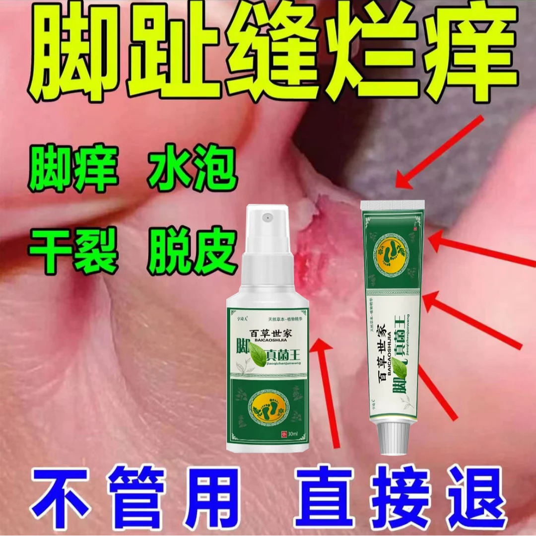 脚趾缝臭痒专用脚痒脚臭止痒膏神器脚丫脱皮抑菌膏开裂克星喷雾剂