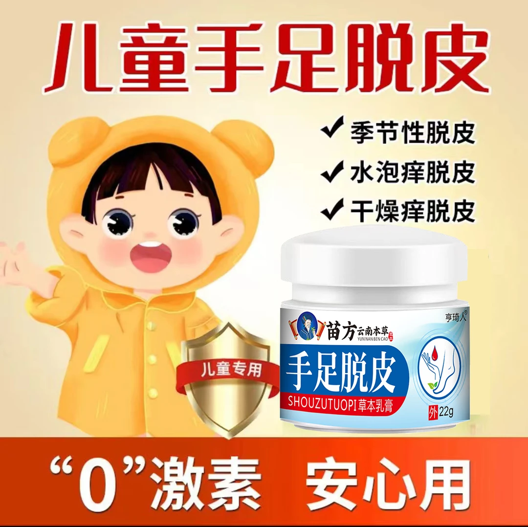 手脱皮手足软膏手痒手脱皮皮肤干燥起皮脱皮手脚脱皮护理软膏