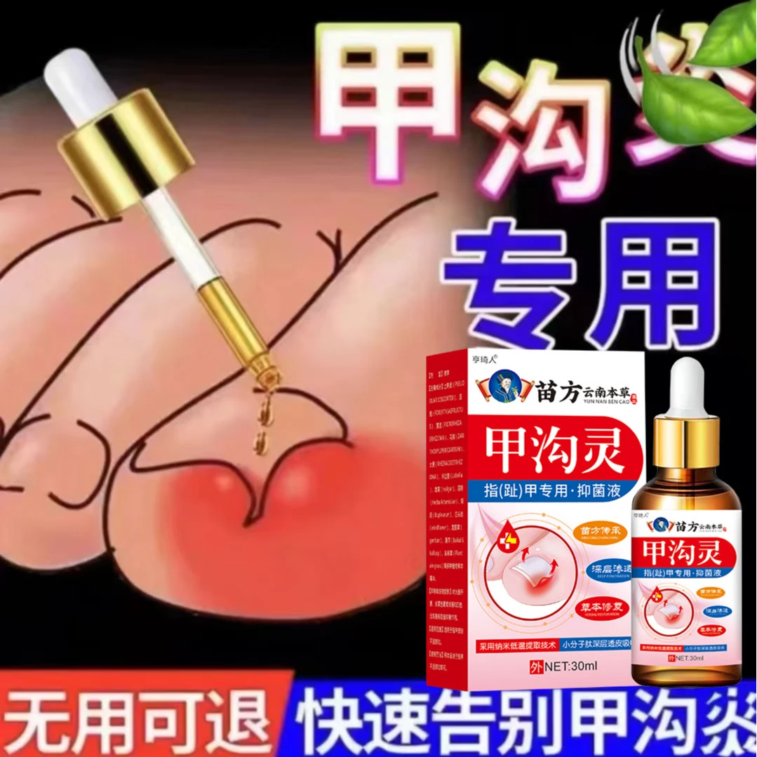 指甲长肉里甲沟软甲脱甲趾指甲嵌甲肉芽脚指头疼甲沟膏
