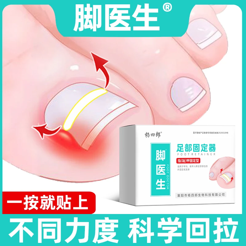 JIAOYISHENG/脚医生脚趾甲贴片医用足部固定器