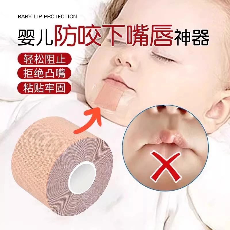 婴儿宝宝睡觉咬下嘴唇干预器小孩咬下嘴唇解决神器儿童防咬下嘴唇