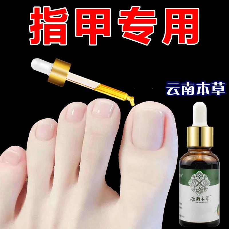 灰指趾甲专用【云南本草】脚指甲正品修指甲草本萃取修脚套盒指甲液