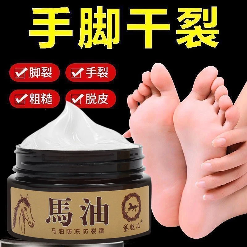 手脚皴裂手脚裂口干燥开裂脱皮脚后跟干裂手脚防裂膏马油护手霜