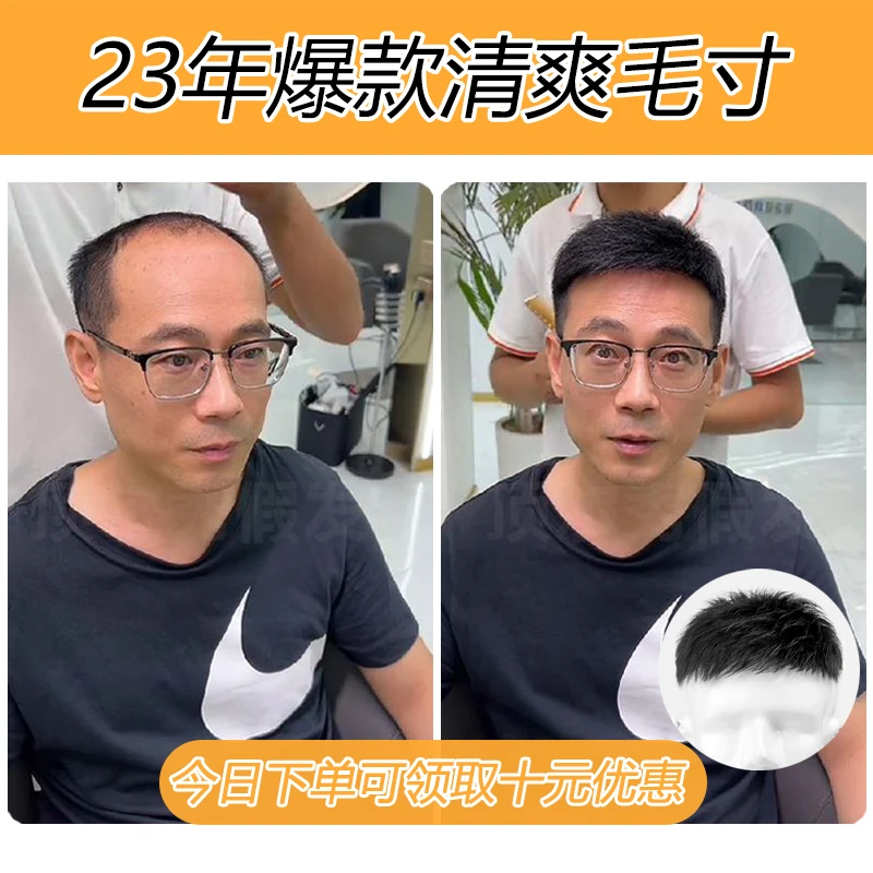 许昌假发男真发无痕隐形毛寸全真发丝男士假发片头顶补发男短款