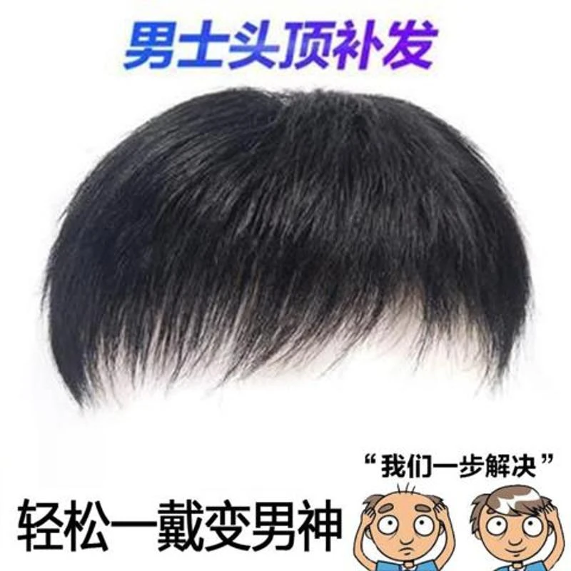 男士补发块寸头短发地中海秃顶全真发透气逼真透气假发补发顶批发