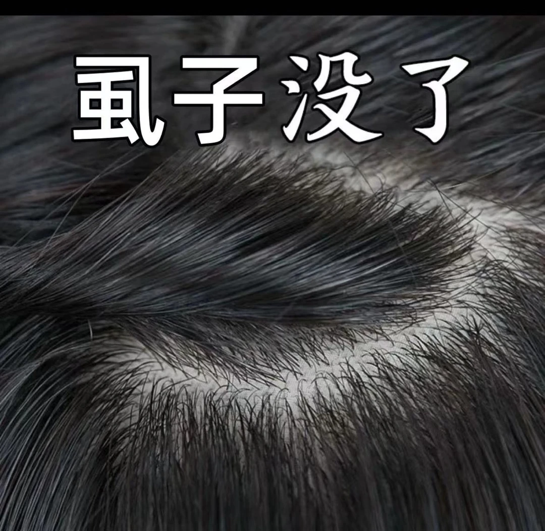 儿童祛虱子百部酊喷雾祛除虱子卵小女孩头发除虱子克星喷剂