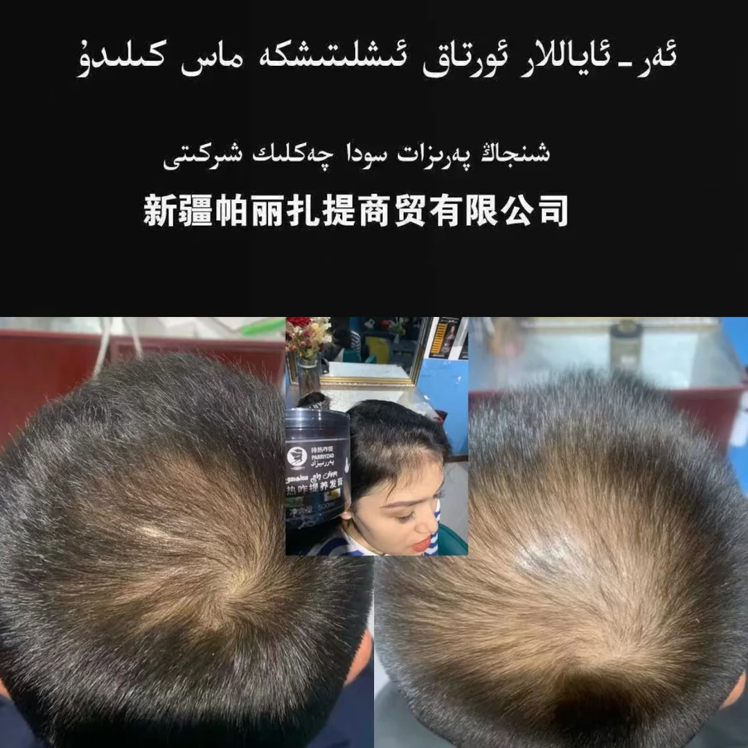 Parizat牙膏膏,护理,控油,防脱,养发滋养,女生,发根,毛囊,快速