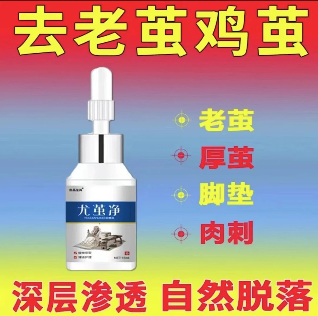 尤茧灵去鸡茧老茧脚趾关节茧手茧子厚茧肉刺自然脱落脚部护理膏液