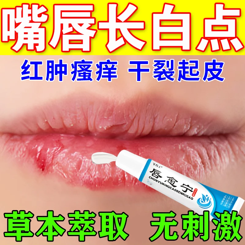 嘴唇皮脂腺异位长白点嘴角红肿嘴巴干裂起皮嘴角上火长泡专用唇膏