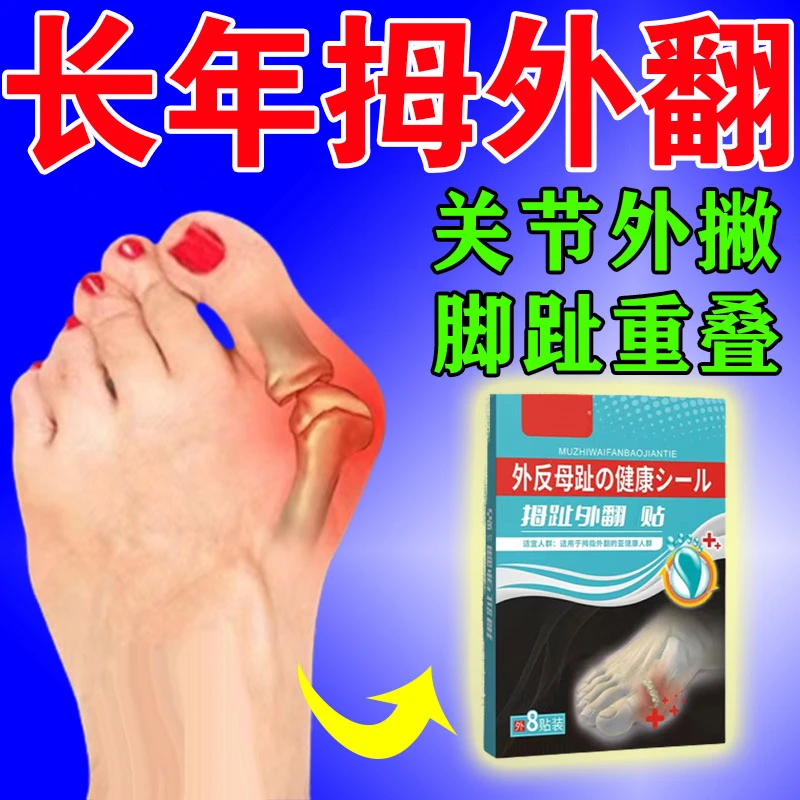 拇指外翻贴神器大脚骨脚趾重叠畸形矫正拇外翻贴脚部