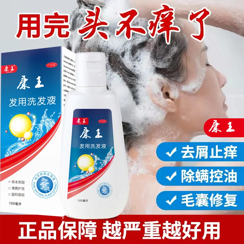 酮康去屑止痒洗发水严重大块头皮屑头痒除螨虫控油康主专用洗发露