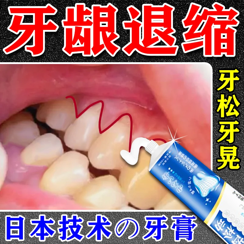 【固齿】牙齿晃动专用牙膏牙齿摇晃活动牙周护理牙龈防护固齿JL