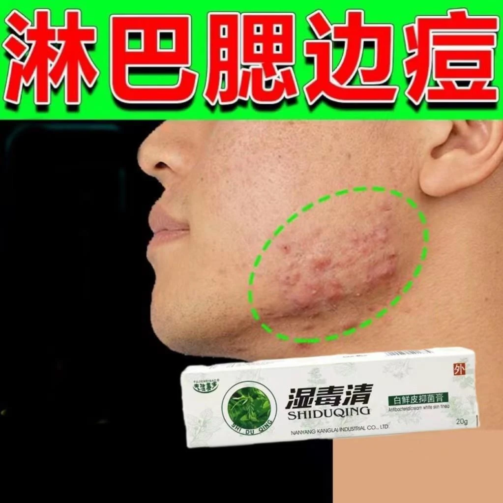 淋巴痘腮边痘下巴痤腮帮子脸颊两边脖子长痘祛痘舒缓肌肤软膏外用