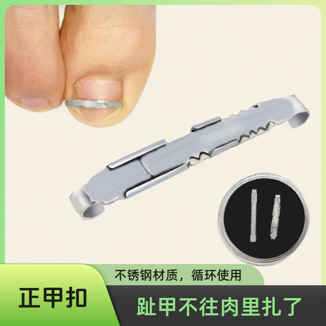 甲沟炎正甲扣脚趾甲长肉里矫正器嵌纠正贴片指甲神器专用矫正甲