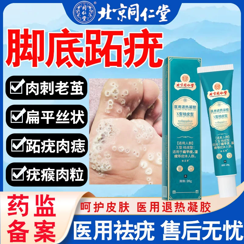 内廷上用肉刺去除膏脚底跖疣祛疣肉刺脚钉膏脚上瘊子老茧去除膏医用退热凝胶