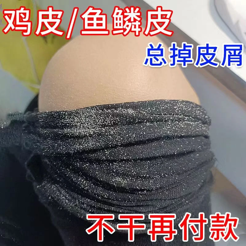 小腿皮干燥起皮掉皮屑腿部皮肤干燥鱼鳞学生补水保湿起皮修复润肤