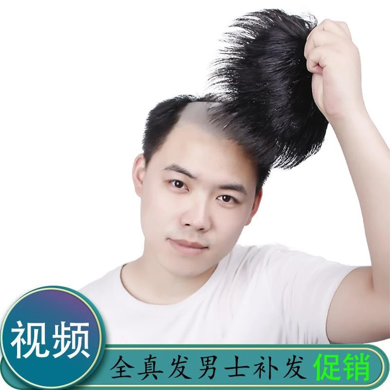 男士补发片假发套头顶补发前额秃顶补发垫接发翻盖假发男发块