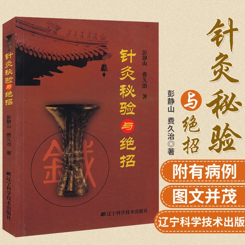 慢性秘验与绝招基本功慢性取穴方法治疗方法疾病穴位图示中医针灸