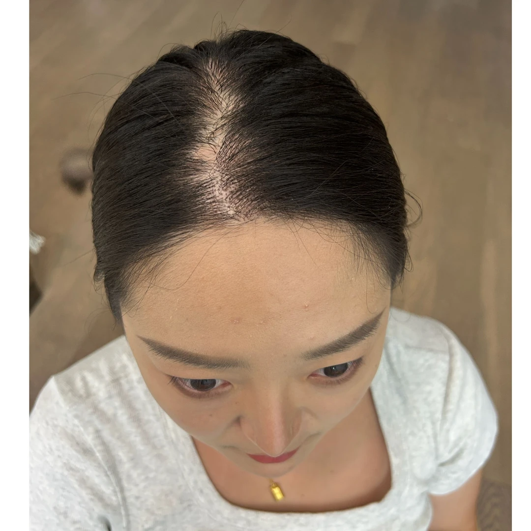 主播真实反馈对比图卡   导液梳