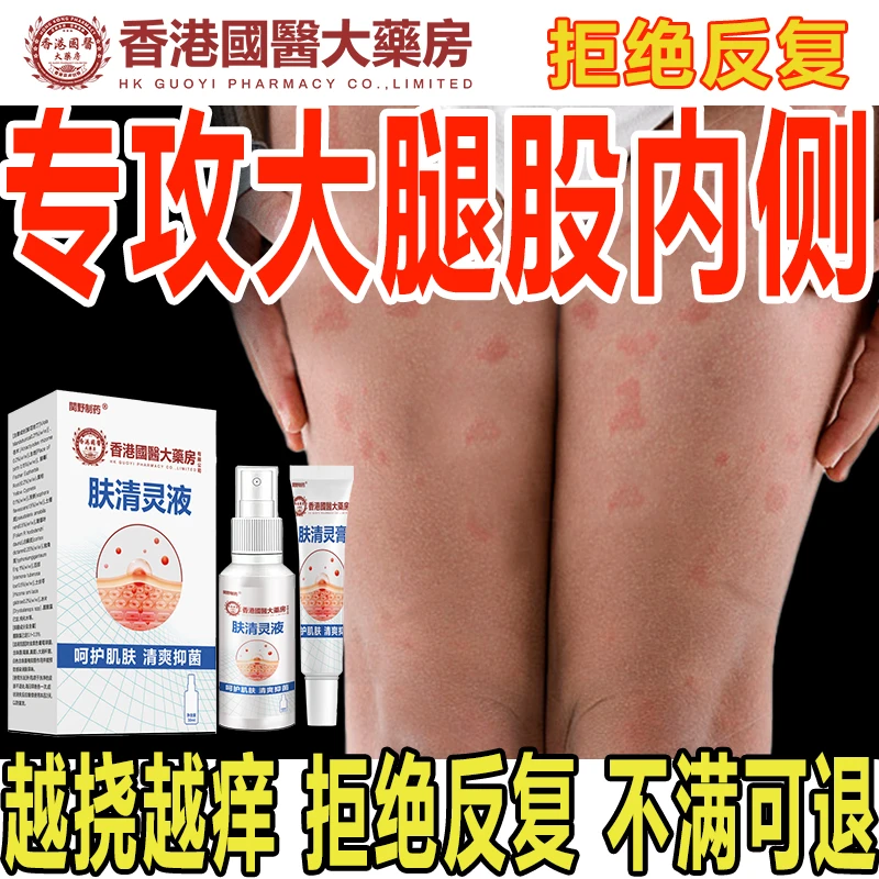 大腿内侧痒去潮湿男士大腿内侧出汗痒大腿内侧止痒膏下体痒
