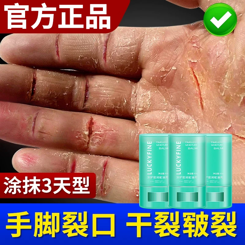 蛇油膏润保湿柔嫩修护手脚开裂脱皮死皮角质老茧粗糙滋蛇油棒男女
