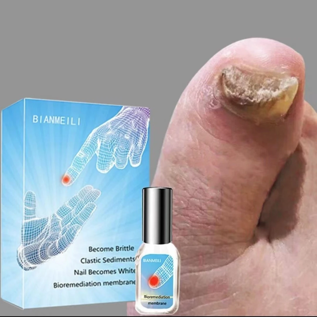 灰只烂厚专用修复液正品蓓美琳生物修护膜