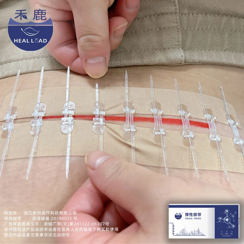 healload/禾鹿拉链式减张器剖腹产外伤免缝针手术减张贴弹性绑带