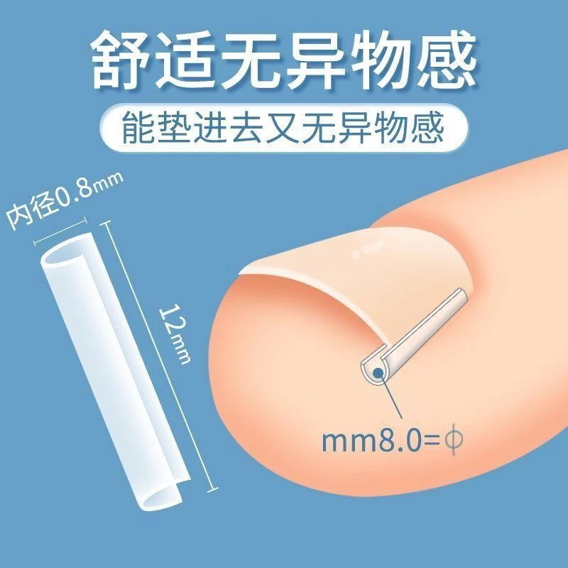 甲沟炎神器脚趾甲扎肉专用嵌甲矫正器纠正指甲长肉里隔离填充垫片